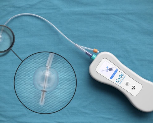 Darstellung eines medizinischen Steuergeräts mit Ballonkatheter als fotorealistisches 3D-Rendering inklusive zweier Detailvergrößerungen Fotorealistisches 3D-Rendering eines medizinischen Steuergeräts mit Ballonkatheter und zwei Vergrößerungen zur Detailansicht.